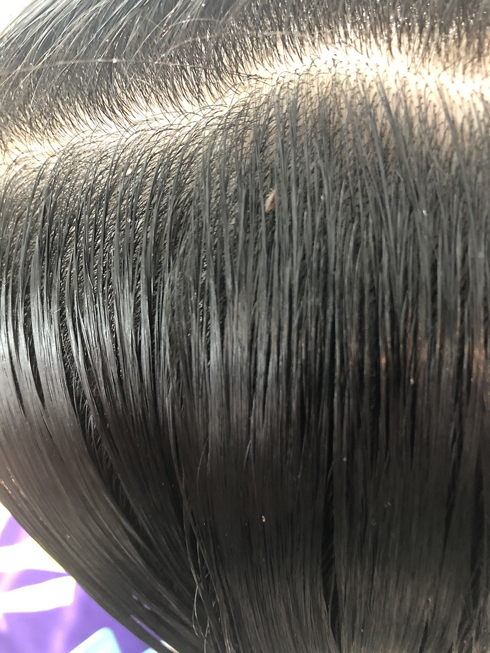 Birmingham, Alabama Lice Treatment & Lice Removal Service LiceDoctors